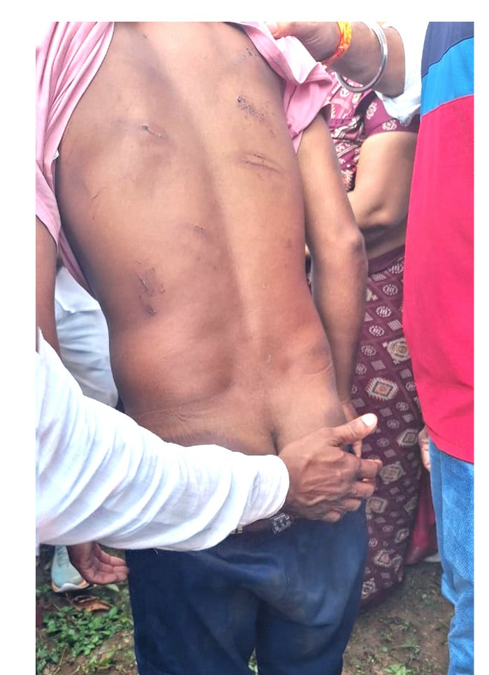 *कवर्धा,छत्तीसगढ़ एक शांतिप्रिय प्रदेश है – यहां ऐसे जघन्य अपराधों और पुलिस बर्बरता का कोई स्थान नहीं है,,छन्नी चंदु साहू*