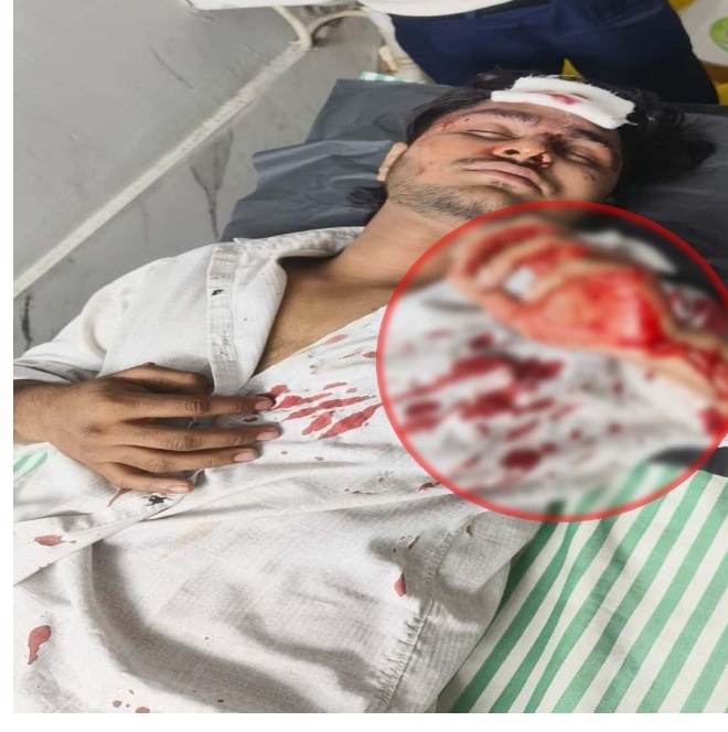 *रायपुर, संदल,चादर में विवाद के बाद चाकूबाज़ी की घटनाएं,,वारदात में चार युवक गंभीर रूप से घायल हुए*