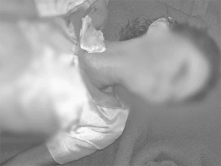 *रायपुर,,दामाद ने सास को मार डाला,,आरोपी दामाद फरार*