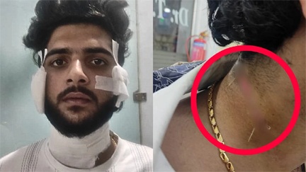 *यश शर्मा हत्याकांड के मुख्य गवाह पर जानलेवा हमला*