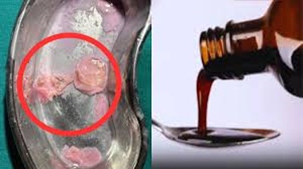 *सीरप की बोतल में संदिग्ध वस्तु मिलने का मामला, जांच के लिए नमूने को भेजा गया राज्य औषधि परीक्षण प्रयोगशाला*