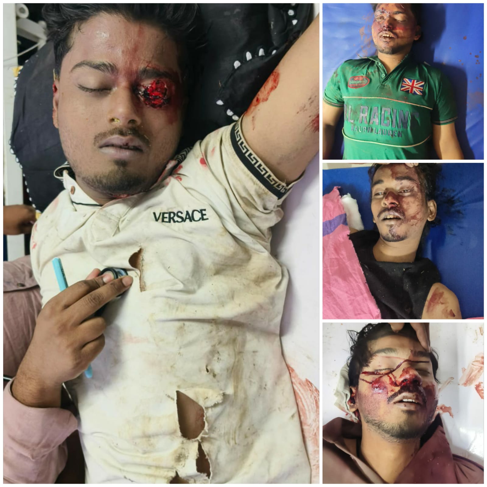 *रायपुर,,भीषण सड़क दुर्घटना में चार युवकों की मृत्यु, पीड़ित परिवारों को तत्काल सहायता देने की मांग।*